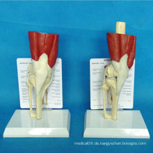 Medizinische Unterricht Kniegelenk Skelett Anatomie Funktionsmodell (R040105)